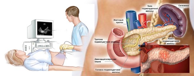 УЗИ брюшной полости